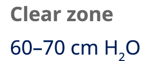 Clear zone 60–70 cm H2O