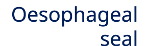 Oesophageal seal