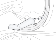 Rectangle